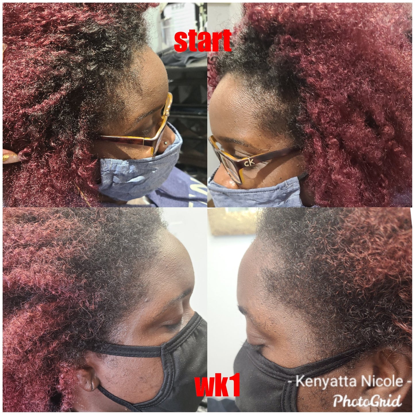 Nora Regrowth serum infused with over 25 essential oils. Helps with hair growth,  edges and dry scalp. See Results in 7-14 days. Order yours today at www.theknstore.com to grow your hair and edges.. 